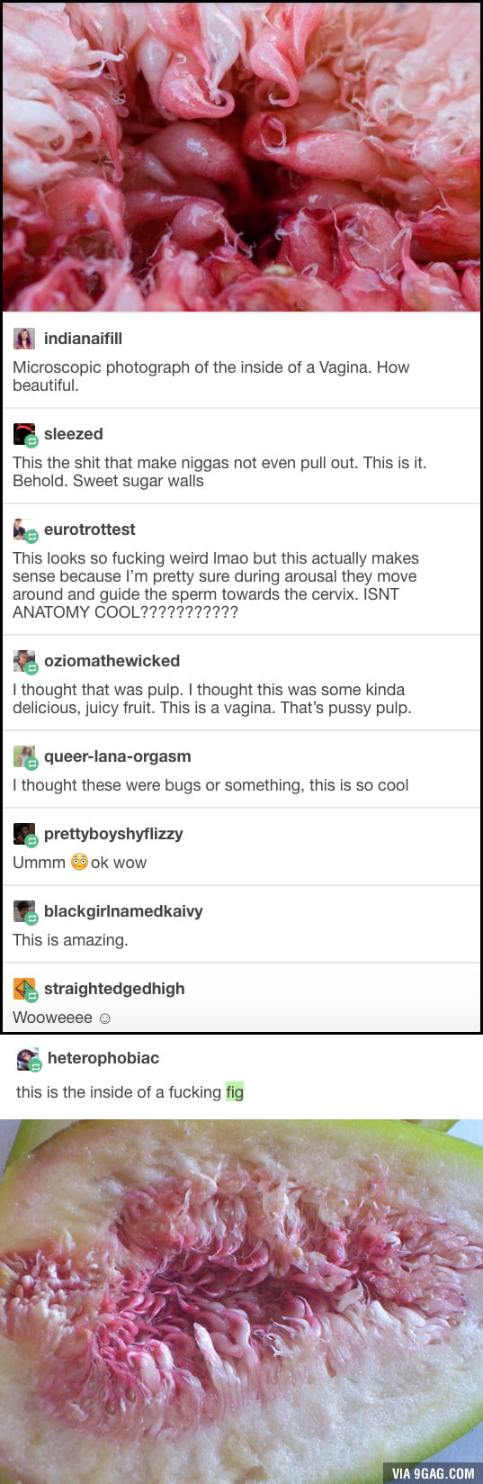 What is a vagina suppose to look like