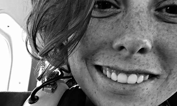 Alaska stole my freckles. Vitamin D deficiency is REAL. - 9GAG