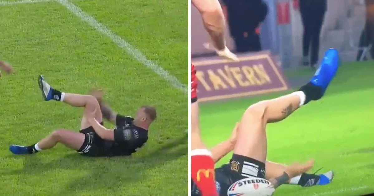 Rugby Player Dislocated His Knee Punches It Back And Hops Into Scrum 9gag