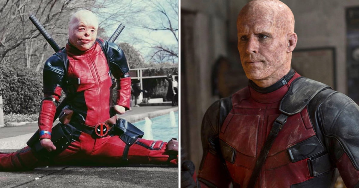 Ryan Reynolds Responds To Burn Survivor's Deadpool Cosplay - 9GAG