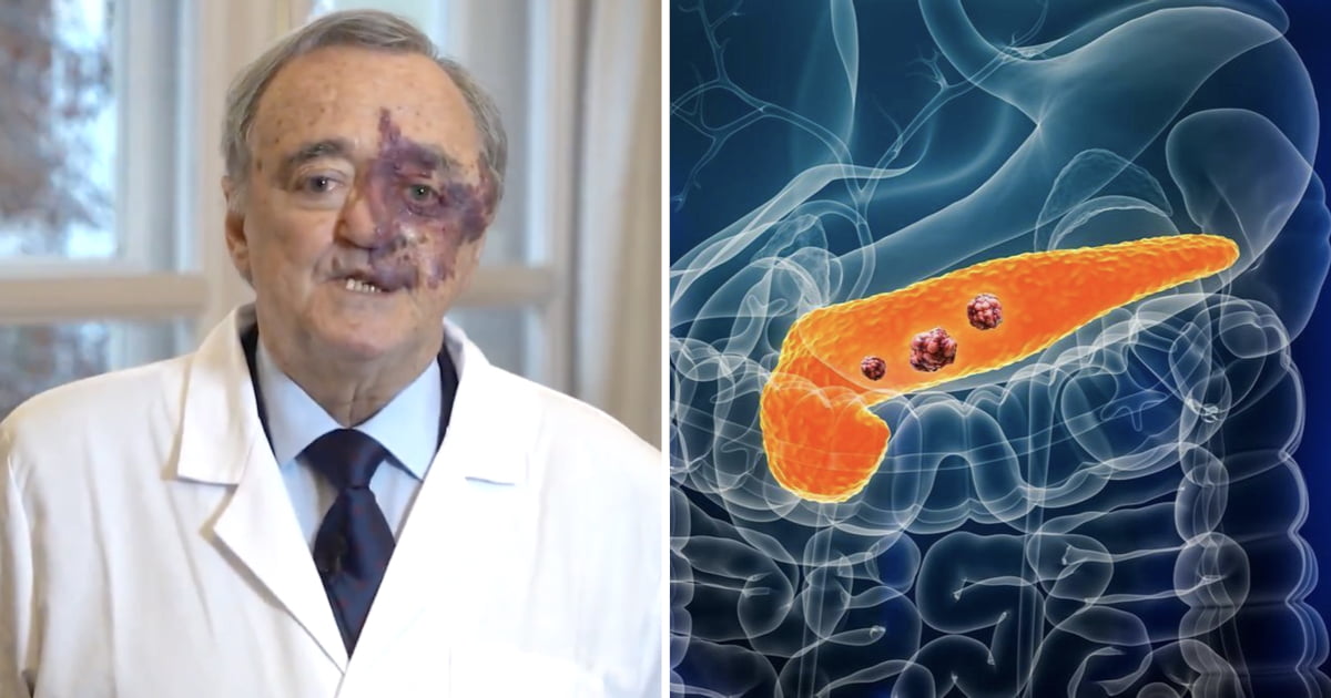 Spanish Scientists Cured Pancreatic Cancer In Rats In Major Breakthrough - Science & Tech