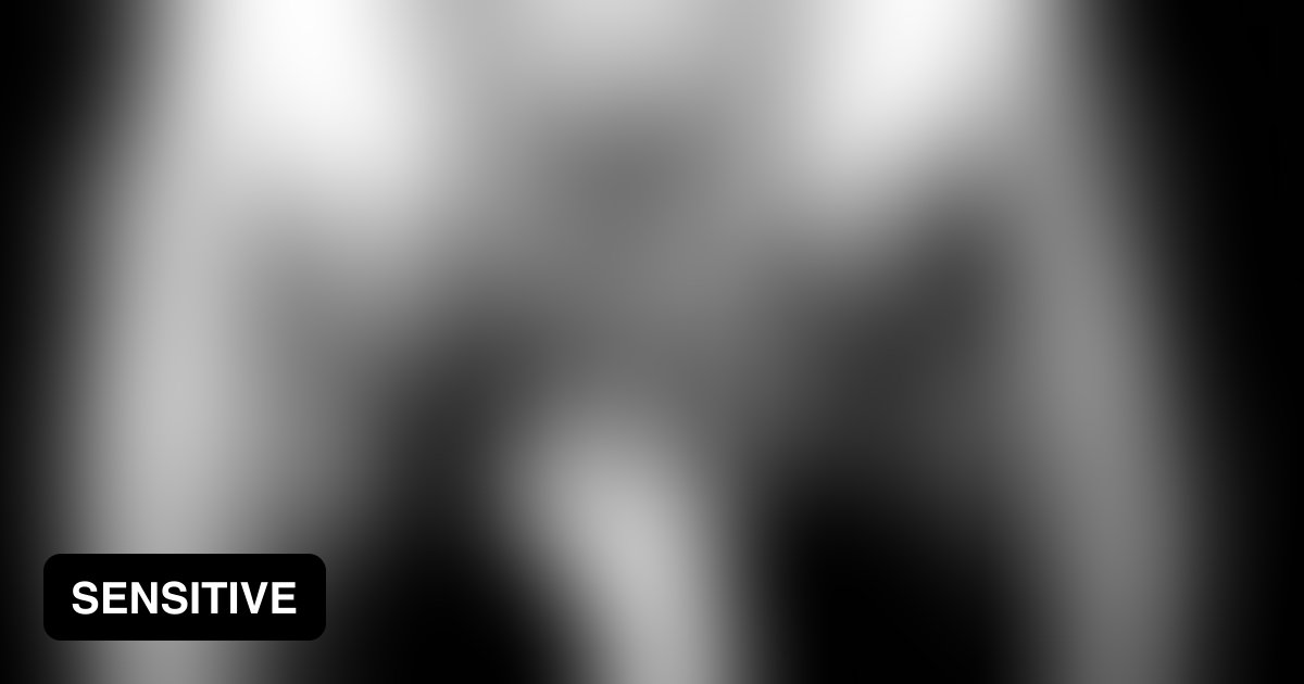 Just an xray... if you know what I mean. 9GAG