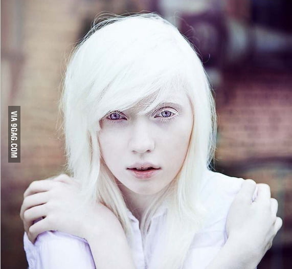 Beautiful Albino Girl Gag