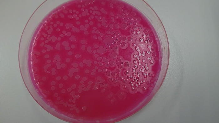 Microbiological Research On Bacillus Cereus In Cake. MYP-agar Petri ...