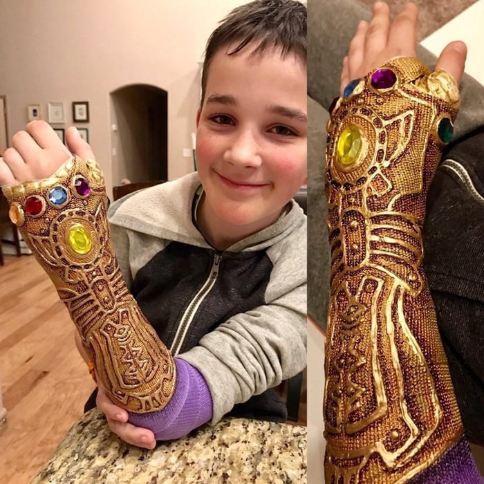 The *best* thing for a broken arm. 9GAG
