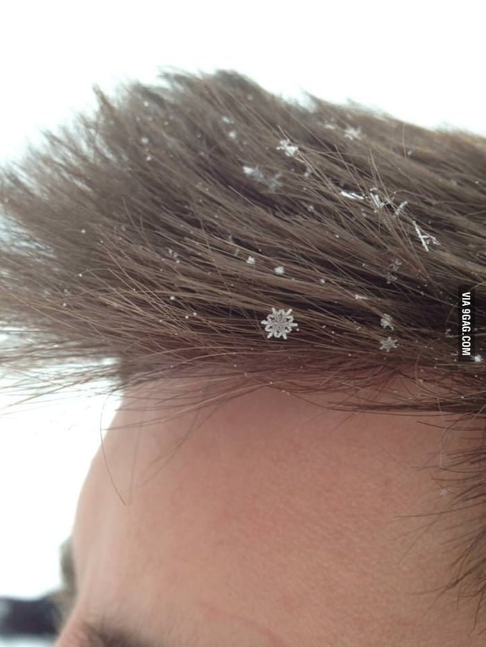 A perfect snowflake fell on hair! - 9GAG