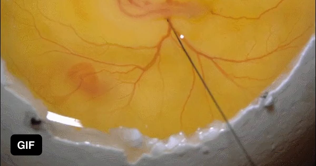 Injecting Ink To Egg Yolk 9gag