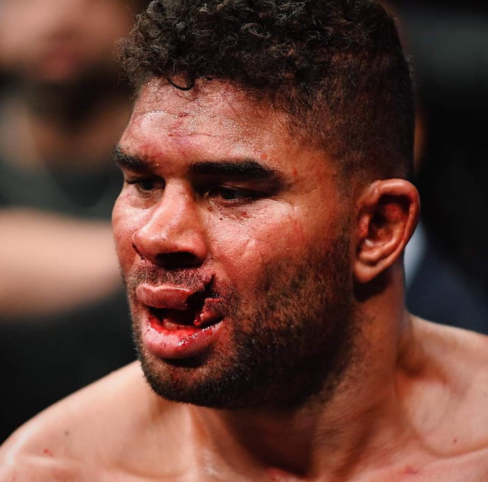 Alistair Overeem Got Knocked Out In The Final Seconds Of His UFC Fight