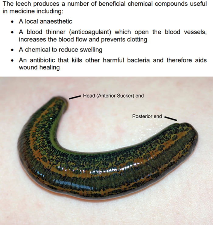 Leeches for medical use today are specifically bred at a leech farm in