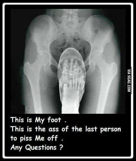 Funny X-Ray - Funny.