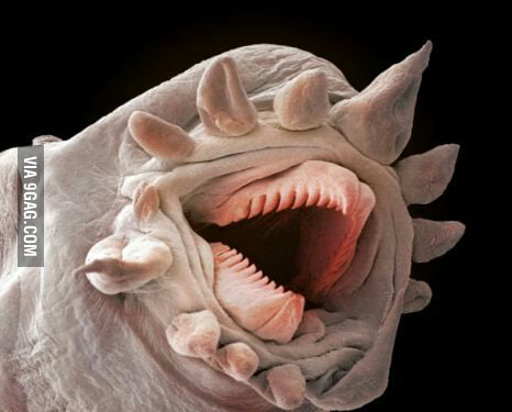 This is a magnified earth worms mouth. Nightmares for everyone