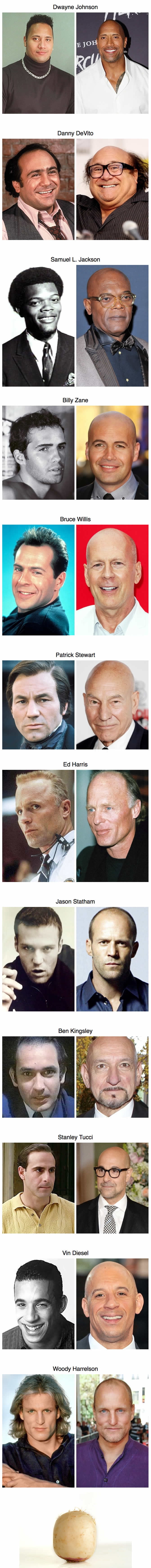 How These 12 Famous Actors Looked Before Going Bald