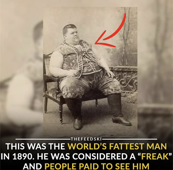 Chauncey Morlan, the fattest man in the world in 1890. He was so fat ...