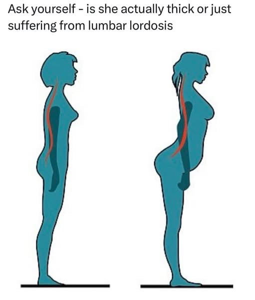dang-gurl-yo-lumbar-lordosis-is-ferocious-9gag