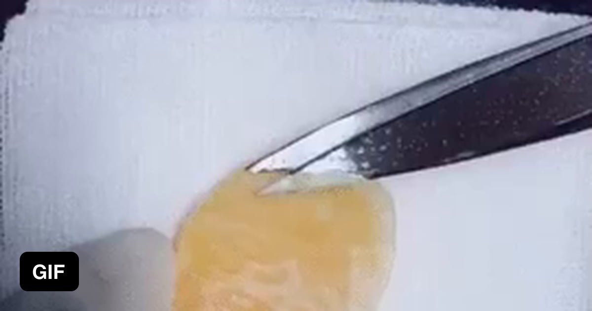 Practicing kidney surgery on a tangerine 9GAG