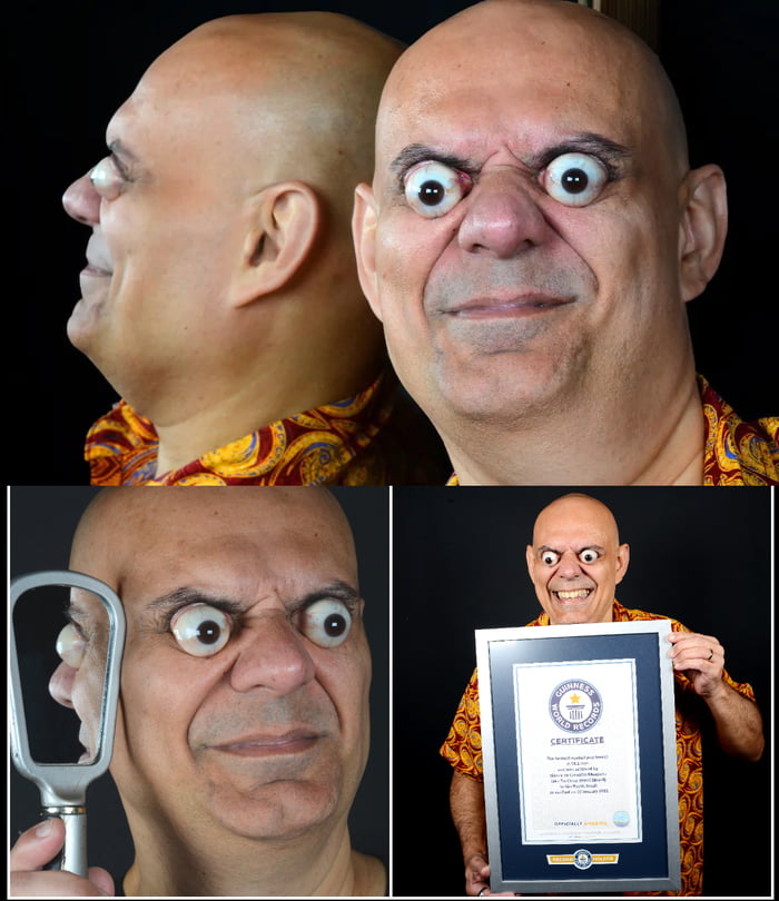 Brazilian man breaks Guinness World Record for ‘farthest eyeball pop