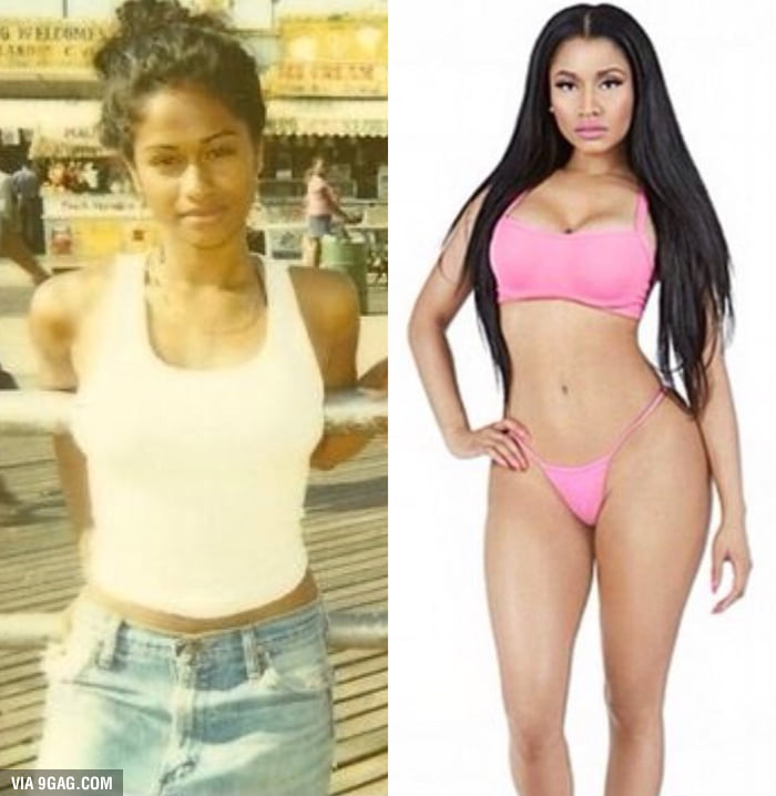 Nicki Minaj Body Before And After 