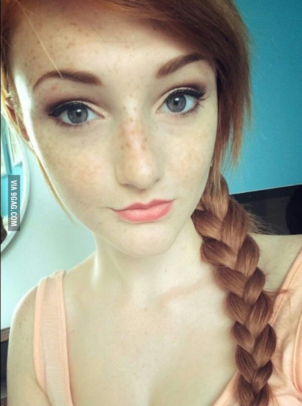 Braids And Freckles 9gag 