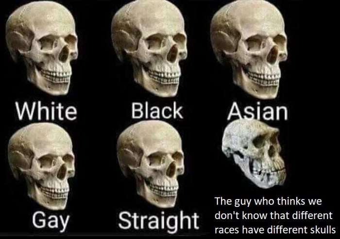 But Did You Know That Different Ethnicities Have Different Skull Shapes Though 9gag