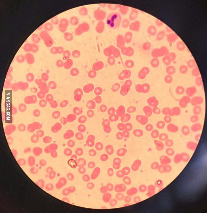 In hematology lab when suddenly... - 9GAG