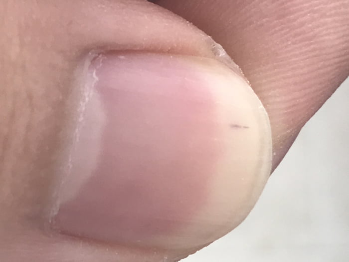 I didn’t know you can grow hair under your fingernails (._.) 9GAG