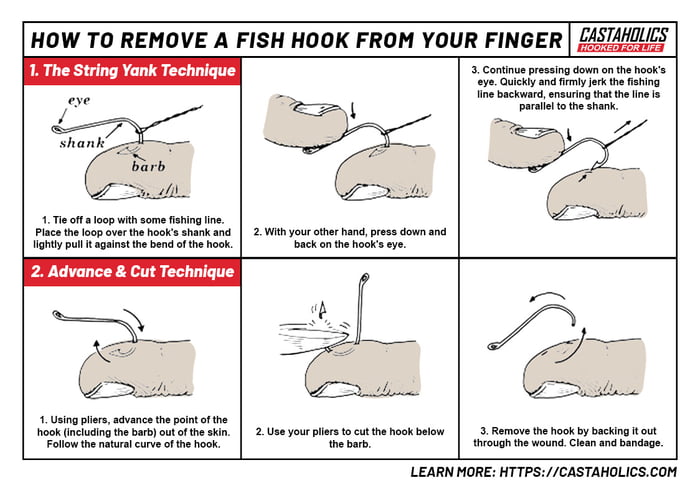 Removing a fish hook from your skin - 9GAG