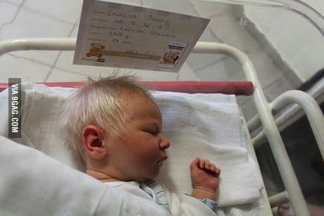 In Hungary Recently A Baby Boy Was Born With Snow White Hair 9gag