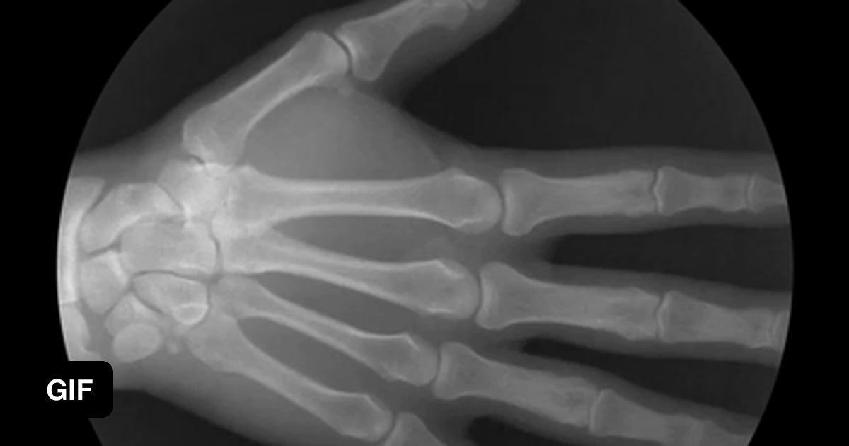 Xray joints in motion 9GAG