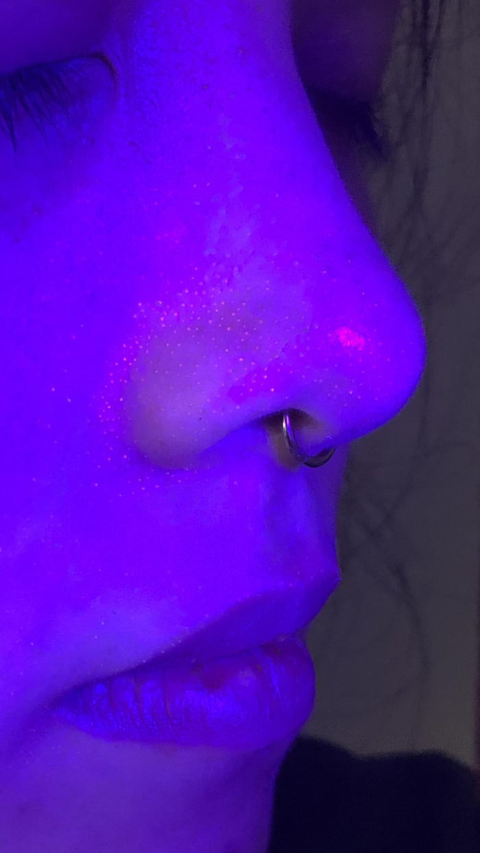 Clogged pores glow orange under a black light 9GAG