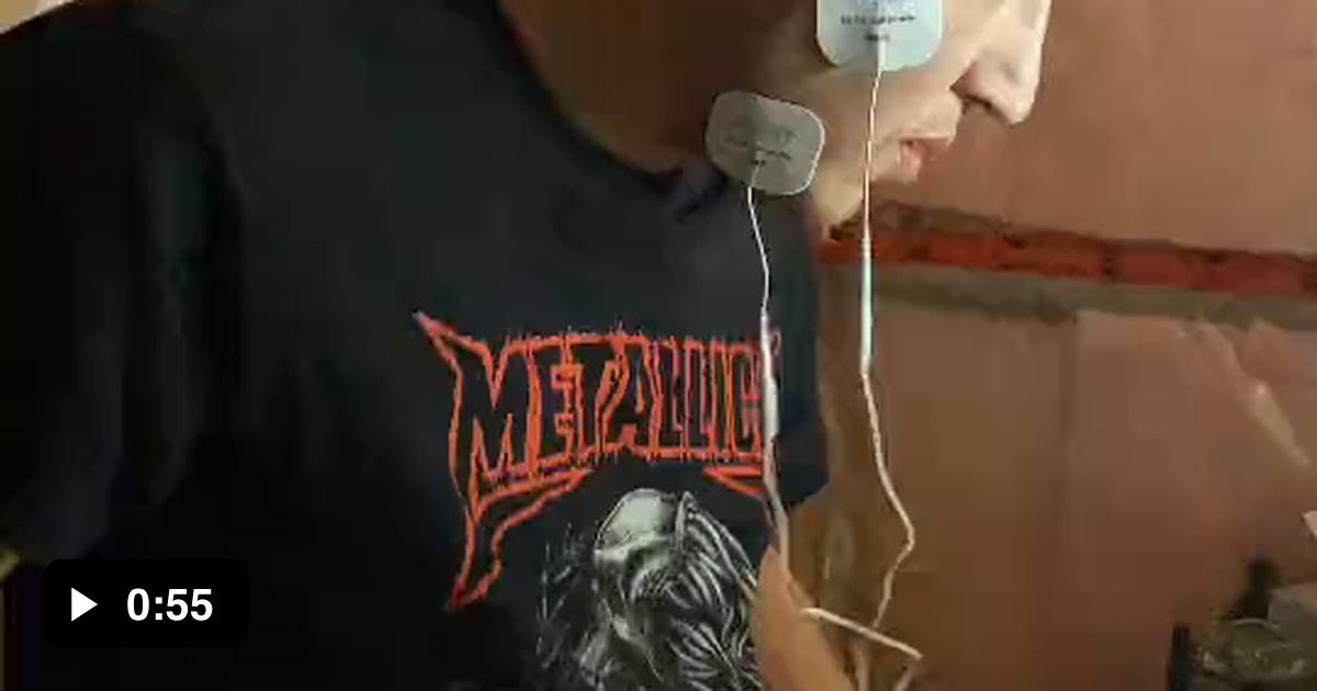 This man's face on electrodes is pure art - 9GAG