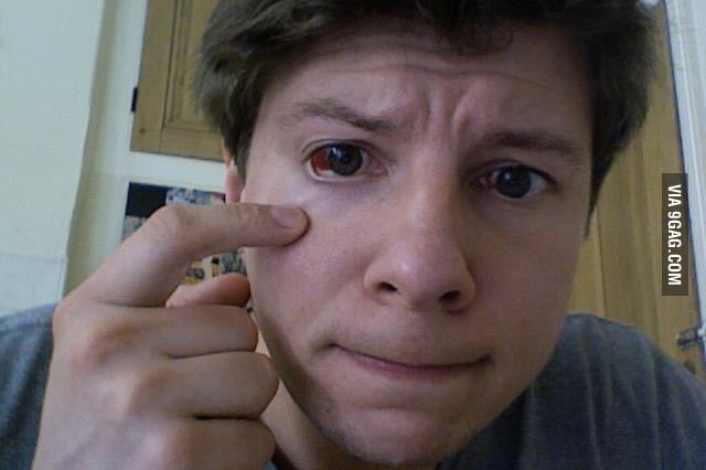Folks This Is Why You Shouldn t Try To Sneeze With Your Eyes Open 9GAG
