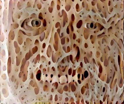 Trypophobia What Is
