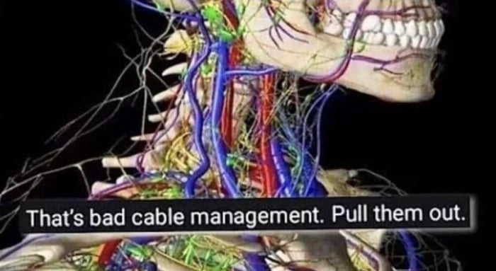 bad-cable-management-9gag