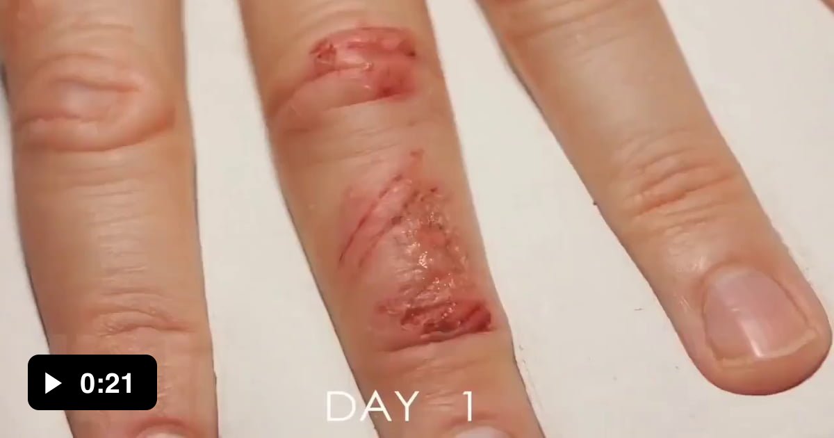 Wound healing 28 days time lapse 9GAG