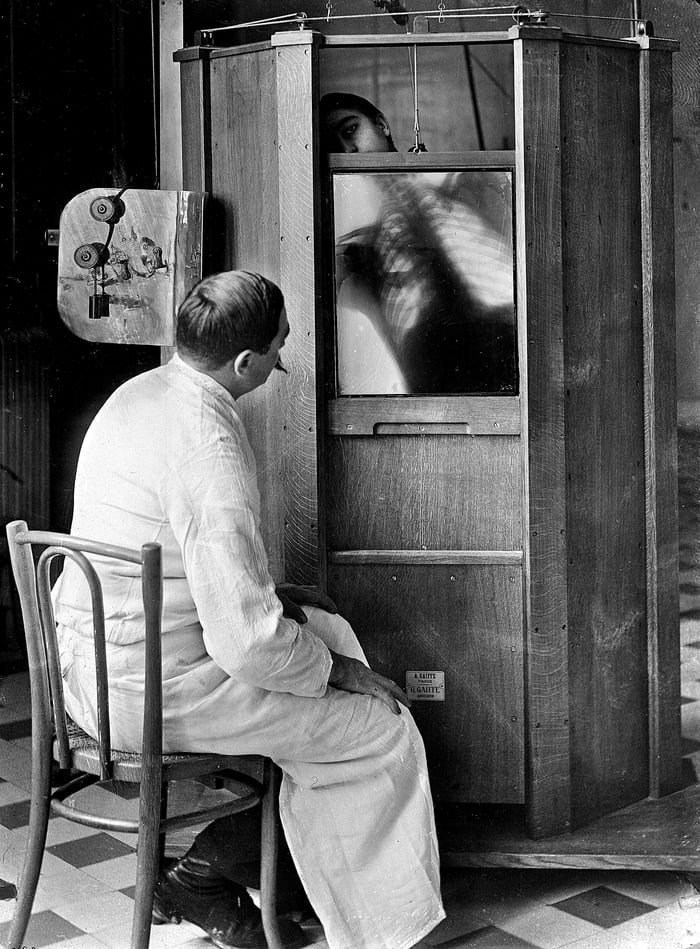 Что можно сделать из старых рентгеновских снимков A chest X-ray in 1914 - 9GAG