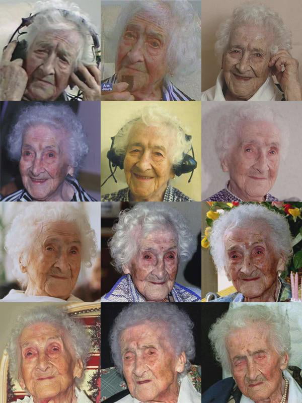 Jeanne Louise Calment In Her Last Years Of Life From 111 To 122 Years