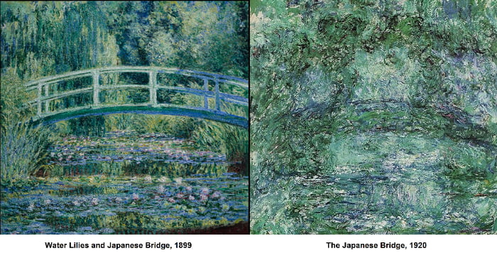 Impressionist painter Claude Monet suffered from cataracts in his later ...