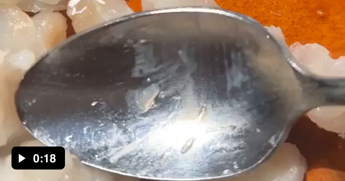 parasite-in-this-guys-raw-fish-meal-aka-the-reason-i-don-t-eat-raw