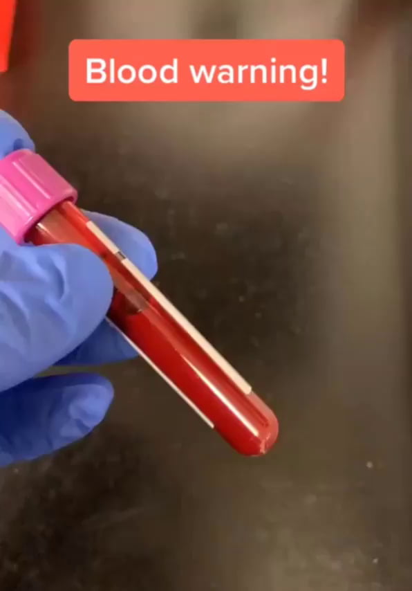 If you ever wondered how your blood work is done. 9GAG