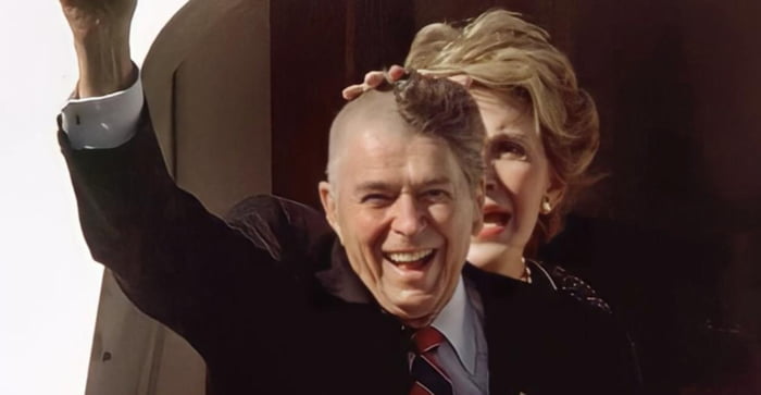 Ronald Reagan Had Half His Head Shaved For Surgery To Reduce Fluid Build Up He Was Also Still