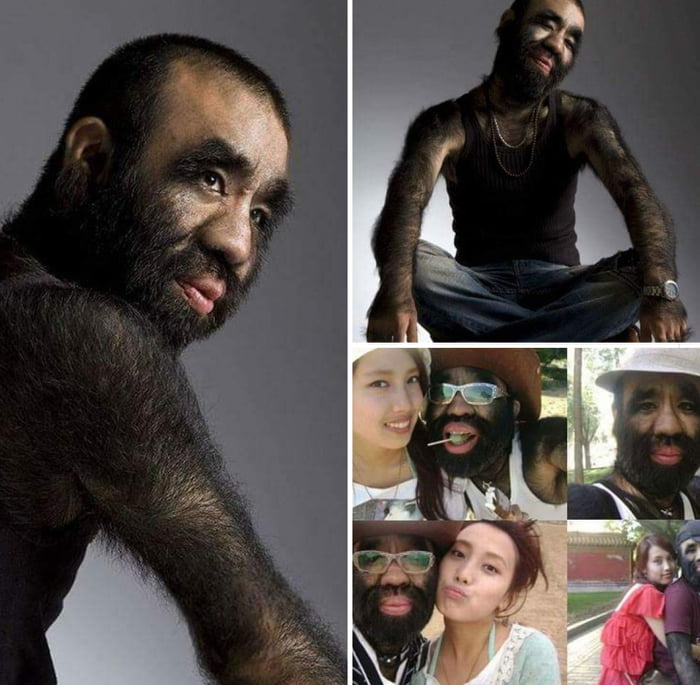 Who Is The Hairiest Girl Alive