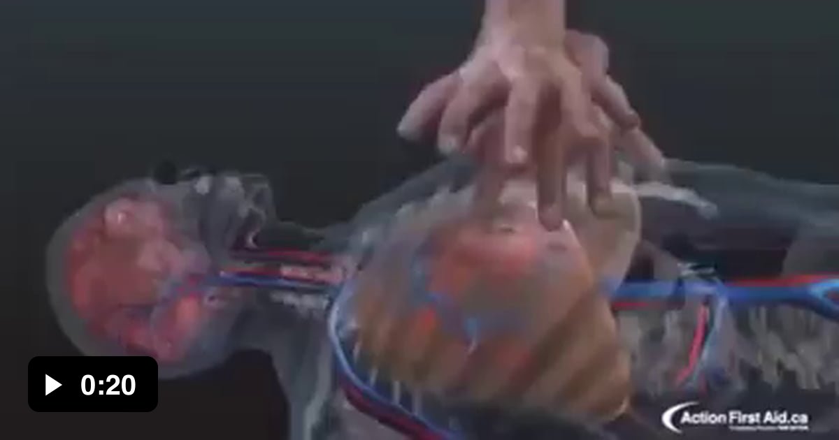 A wonderful visualization of the effects of chest compressions on the ...