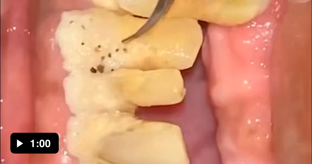 Please don't to brush your teeth! 9GAG