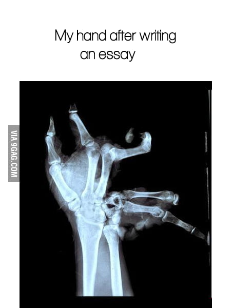 My Hand After A Very Long Essay About Christmas Break Gag My Hand After A Very Long Essay About Christmas Break Examples Of Thesis Statements For Argumentative Essays also Business Plan Writers In Delhi How To Write A Proposal Essay Outline