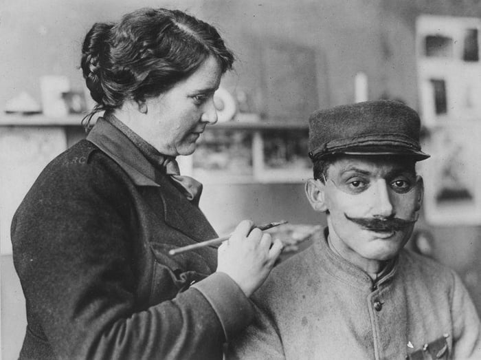 American Sculptor Anna Coleman Ladd Creating A Face Mask For A 