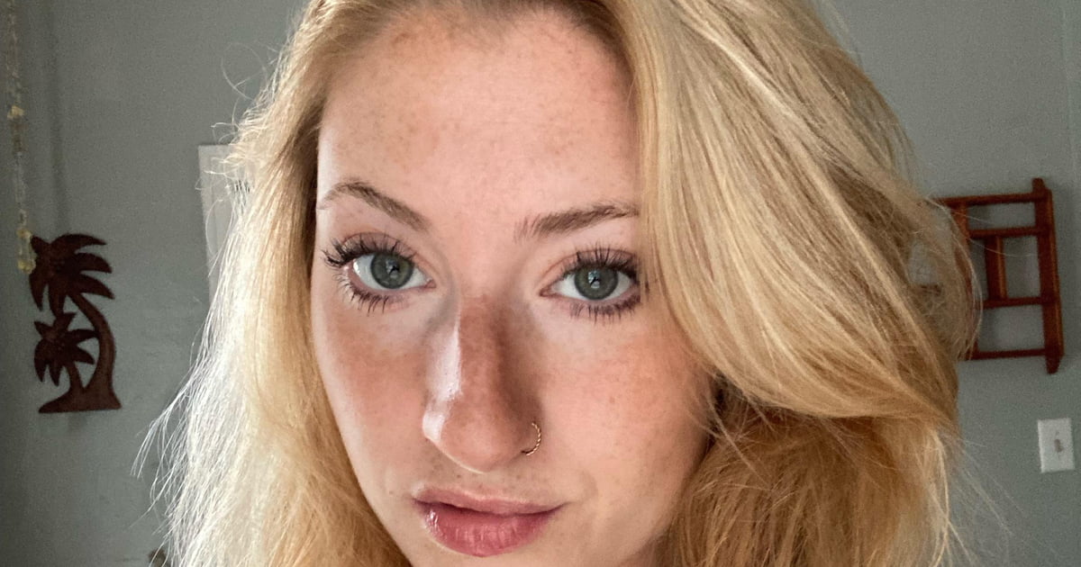 Freckle season is here - 9GAG