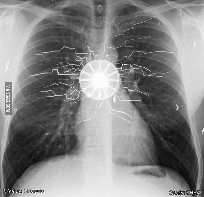 That awkward moment when you realise to whom this x-ray belongs - 9GAG