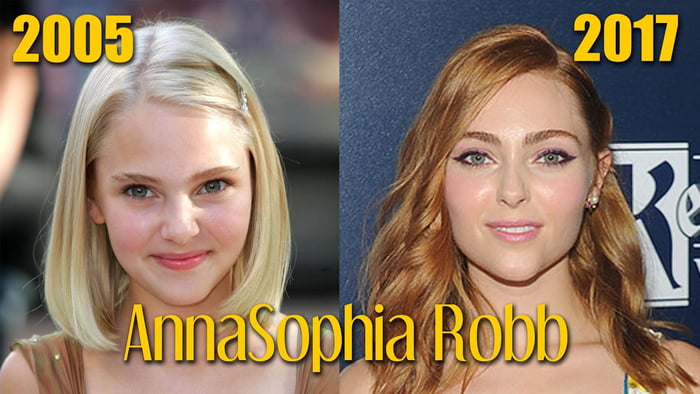 annasophia robb nose job before and after