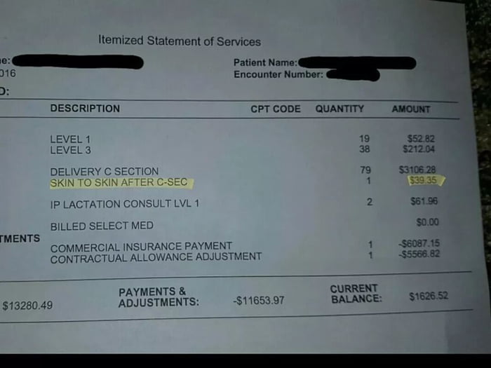 So american hospitals charge 40 bucks to hold your baby after giving