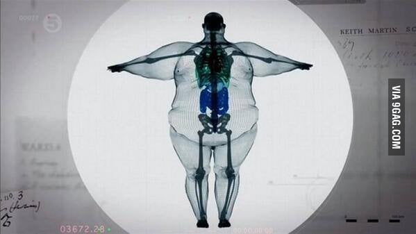 X-ray of a 900lbs man. 